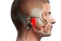 TMJ Disorders Symptoms, Relief and Self-Care